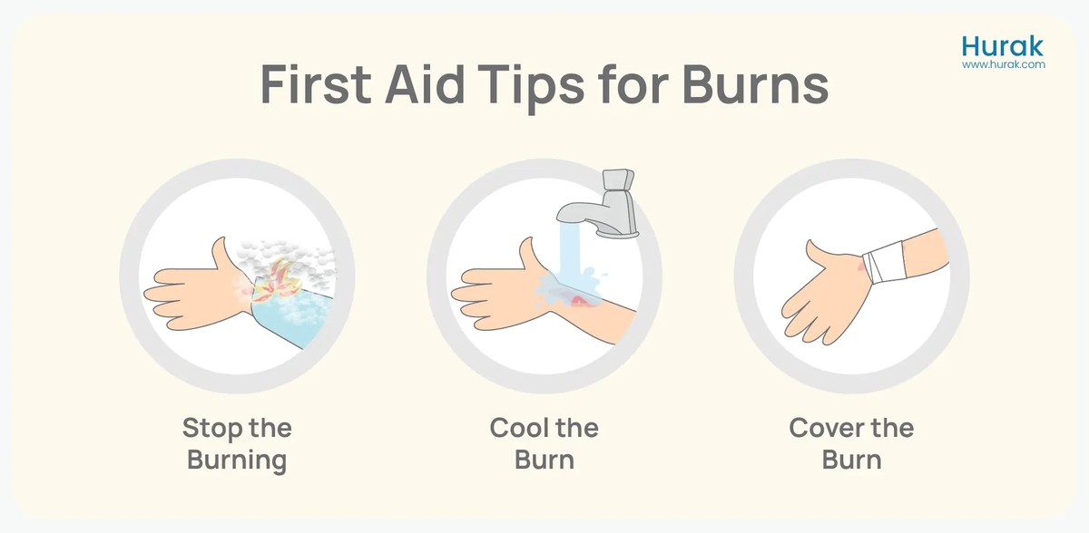 Sanitäter erklären: Warum Sie niemals heißes Wasser zum Abwischen nehmen sollten - image 1