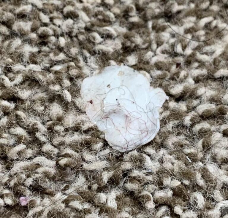 Kaugummi auf dem Teppich? Eiswürfel lösen das Problem in 5 Minuten