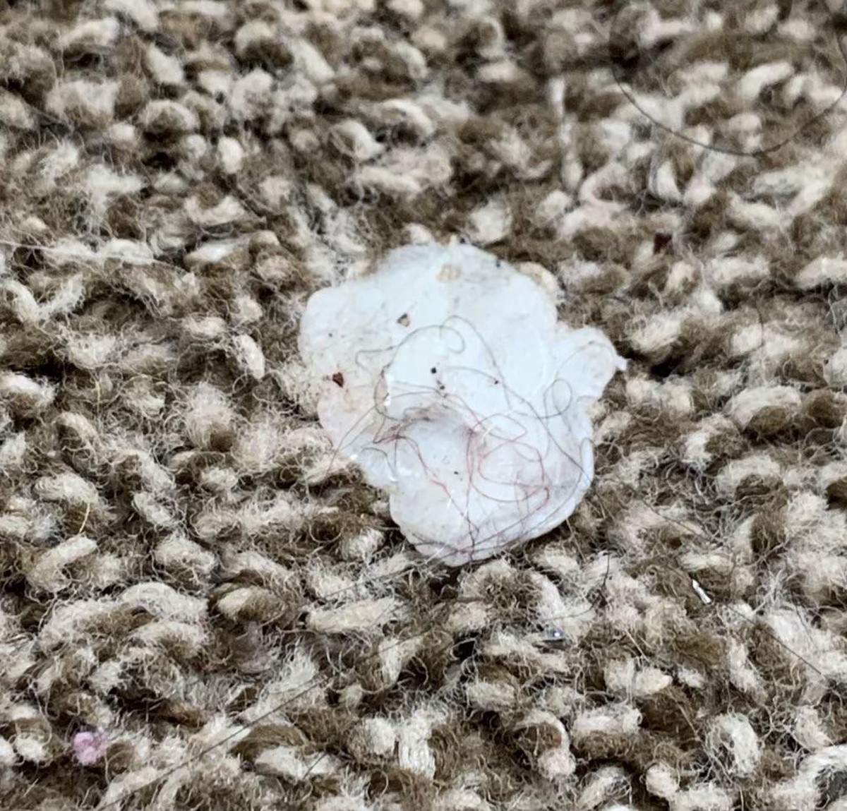 Kaugummi auf dem Teppich? Eiswürfel lösen das Problem in 5 Minuten